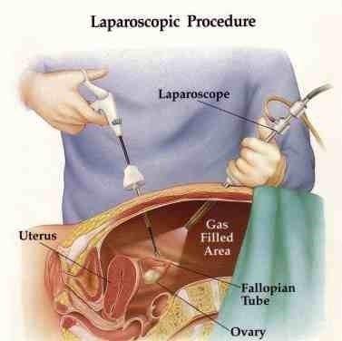 Best Laparoscopic Surgeon in Madhapur