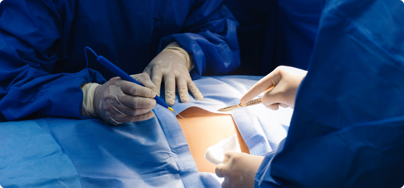 Best C-Section Specialist in Gachibowli for Safe Motherhood