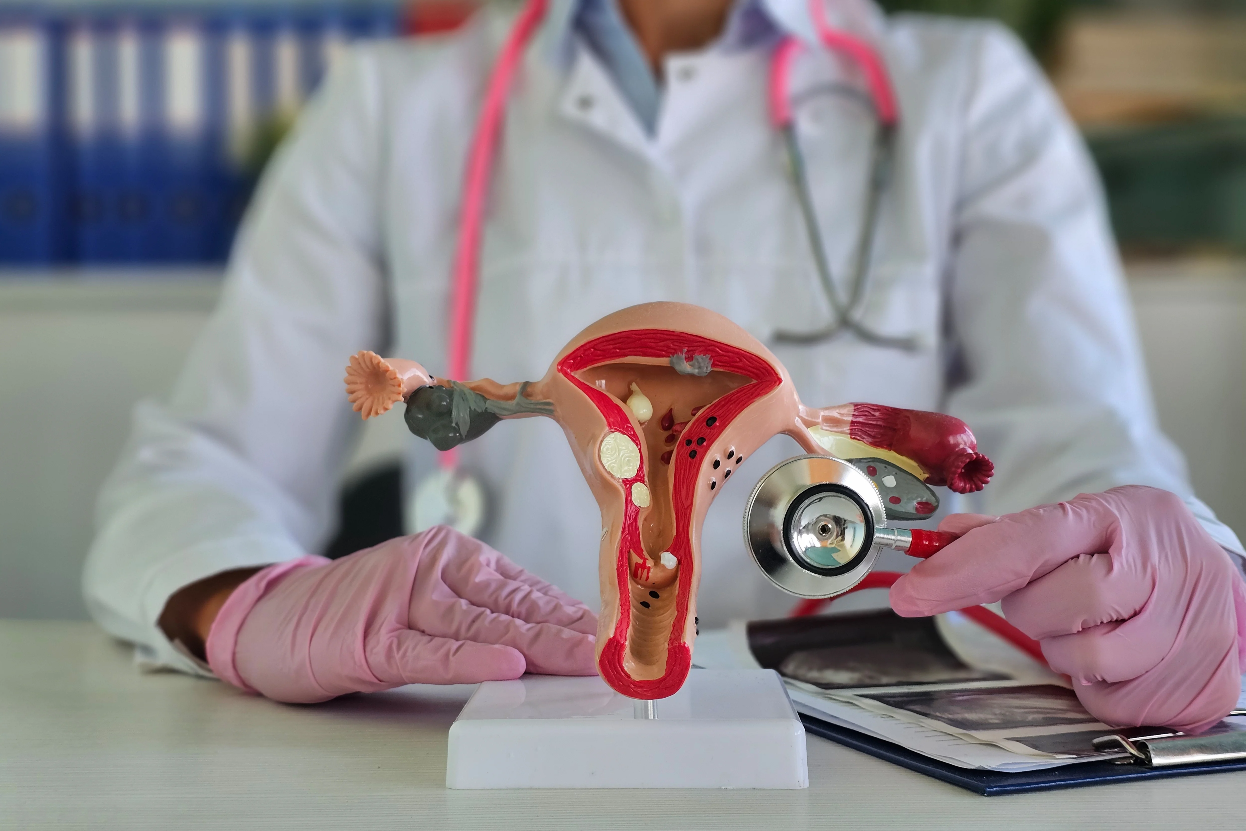 Adenomyosis Treatment