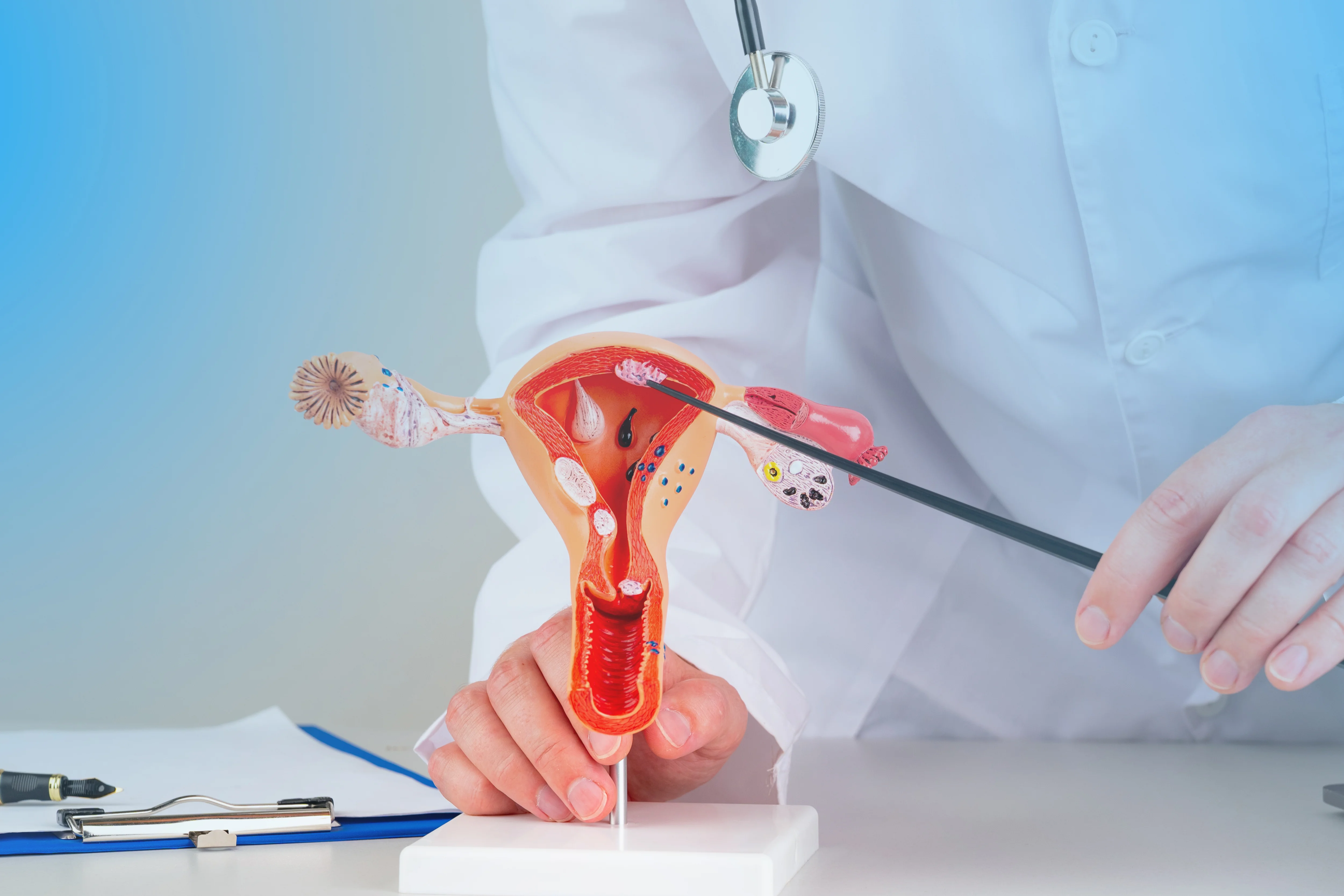 Ovarian Cyst Treatment